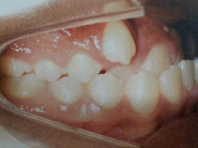 Foto 1 - BOTOX e Bichectomia para pblico GLS